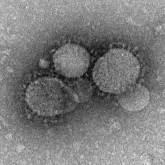 Recent Corona Virus under the microscope